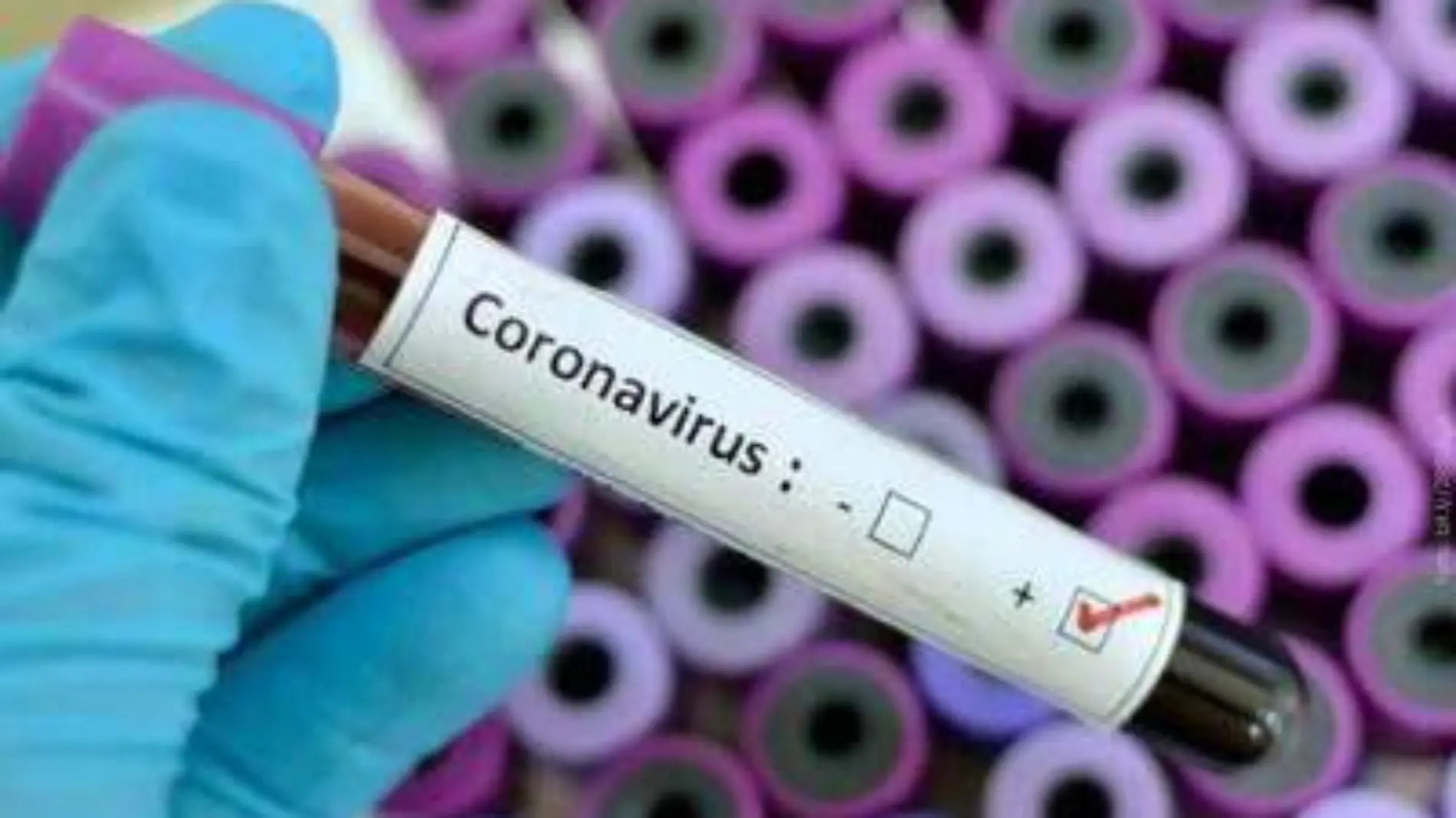 22 WEB Secretaría de Salud de Coahuila se mantene alerta por coronavirus